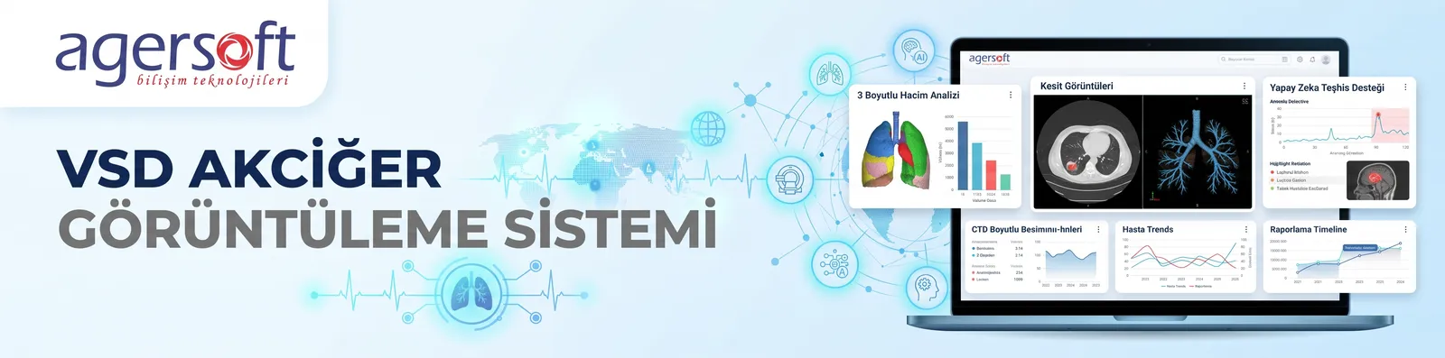 VSD Akciğer Görüntüleme Sistemi (VSD)